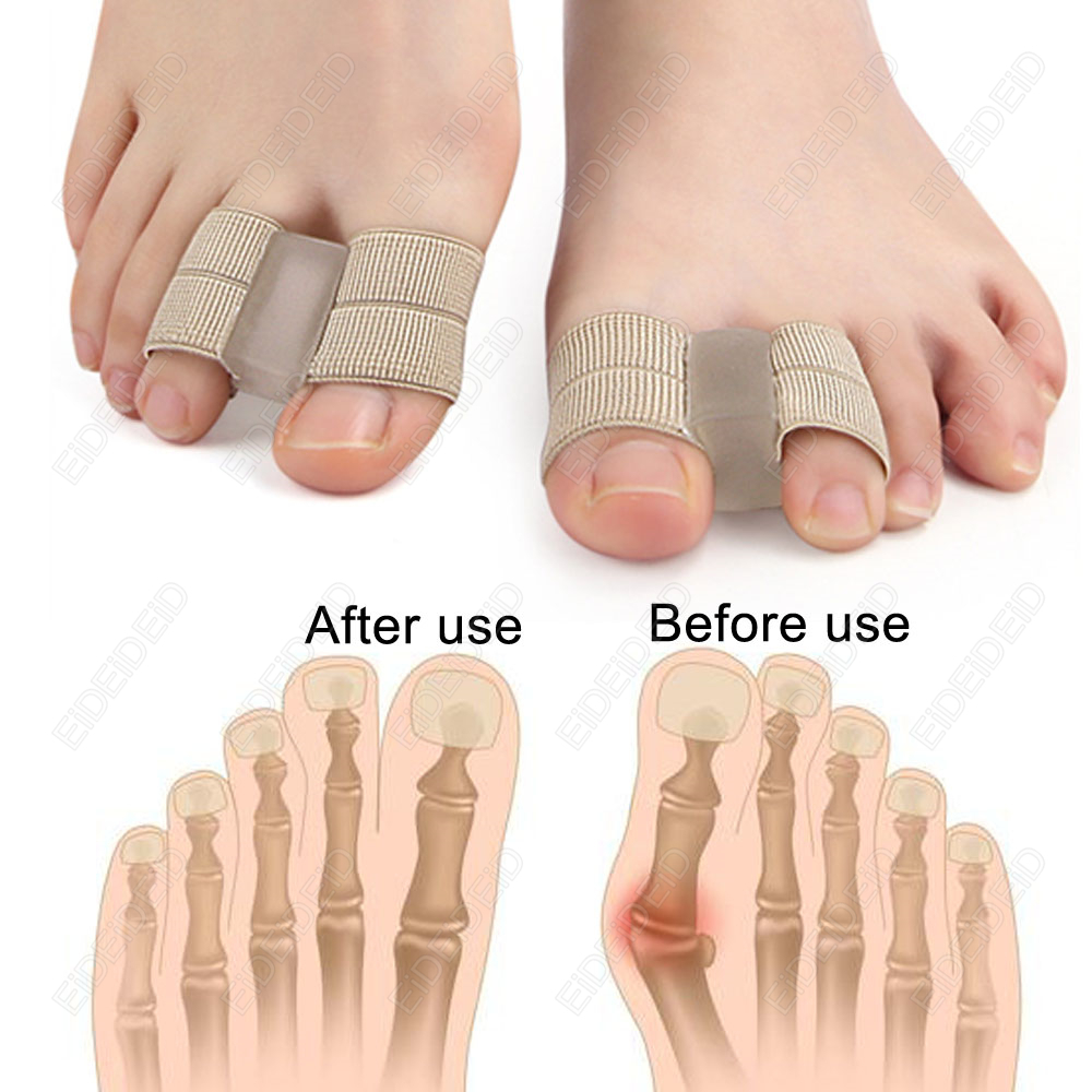Bunion Toe Corrector Orthesen  – Women'S Shoes With Bunions Bewertung und Preis